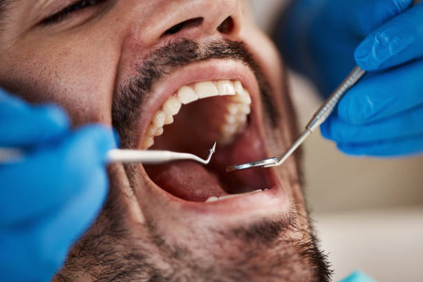 Best Emergency Treatment for Dental Infections or Abscesses in Clementon, NJ